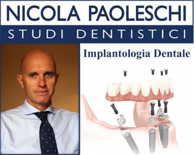 Implantologia a carico immediato Carrara Dr. NICOLA PAOLESCHI