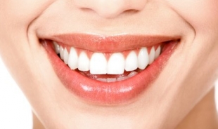 Otturazione dentale estetica Empoli. Andromenda Centro Odontoiatrico