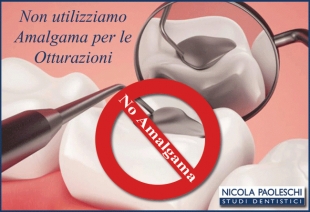 Amalgama otturazioni dentali sintomi, Dr.Nicola Paoleschi