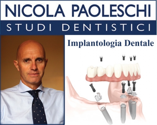 Implantologia a carico immediato Lucca Dr. NICOLA PAOLESCHI