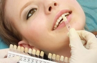 Faccette dentali Empoli. Andromeda Centro Odontoiatrico