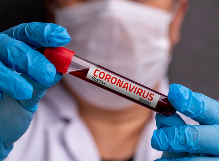 Coronavirus, il M5S chiede chiarezza sui dati e tamponi a tappeto per la fase 2