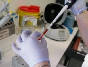 Coronavirus, la minoranza propone il test sierologico per tutti i cittadini di Carrodano