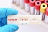 Coronavirus: nessun decesso in Liguria, 85 nuovi positivi nello spezzino