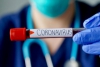 Coronavirus: in Liguria 1023 nuovi positivi