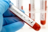 Coronavirus: 6 ricoveri e 21 nuovi positivi in Asl5