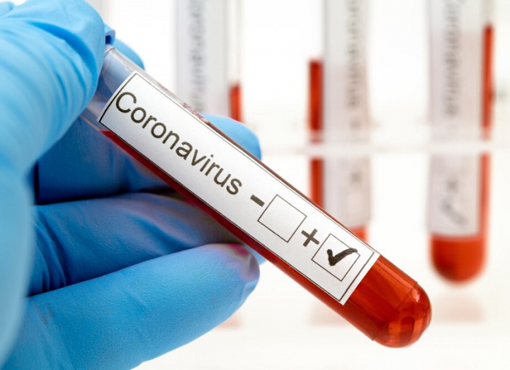 Coronavirus, 16 i positivi nella provincia della Spezia